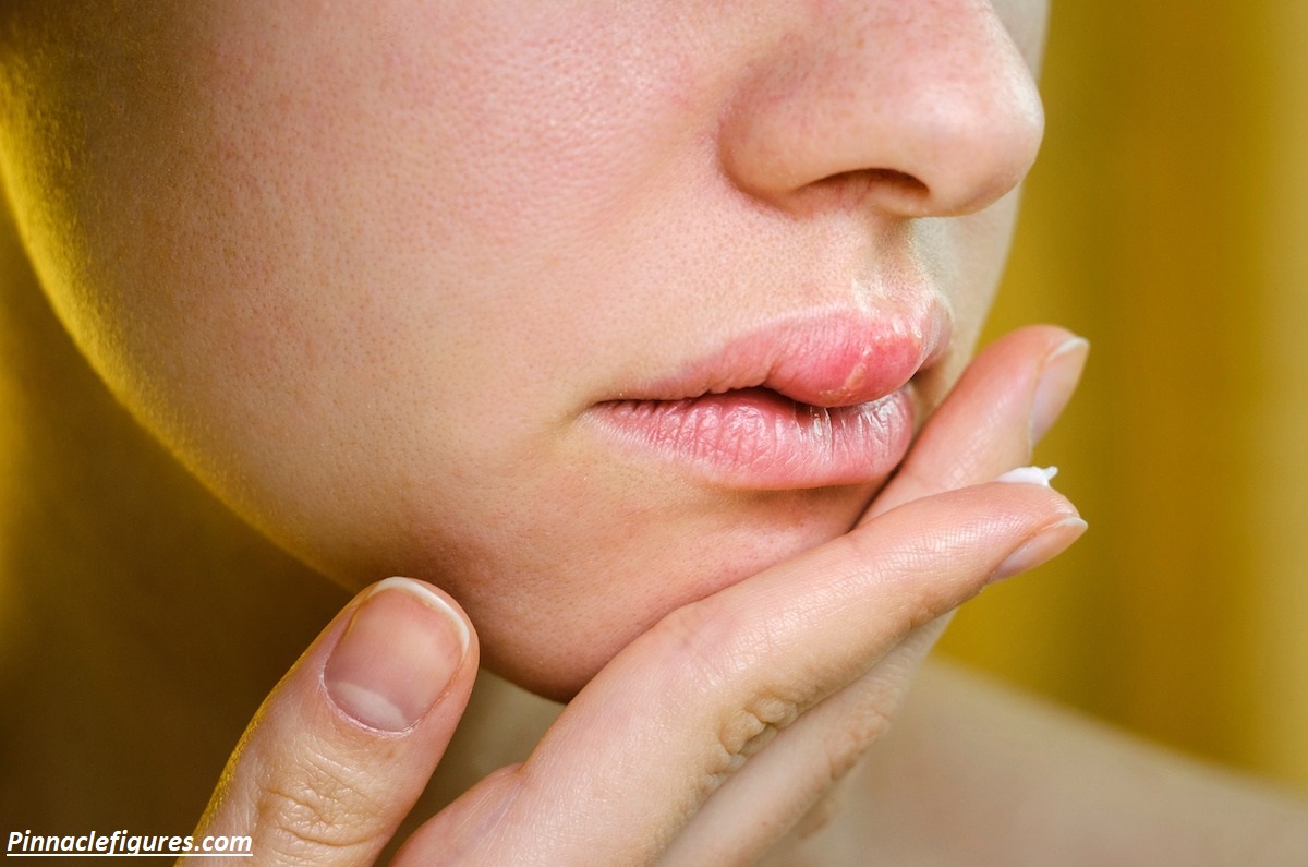 Why Is My Lip Swollen on One Side? 9 Hidden Causes